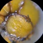 Anthracobia (Anthony Carter)